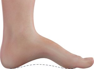 Foot & Ankle Deformity Correction